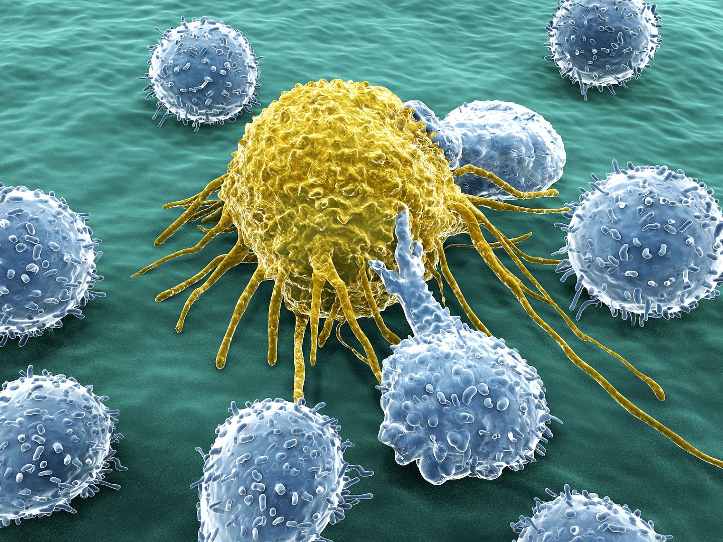 Immune cells attacking cancer cell photo Cancer cell attacked by immune cells_zpskabbpq2m.jpg