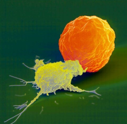Natural killer cell attacks cancer photo natural-killer-cell_zpsejlnriq7.png